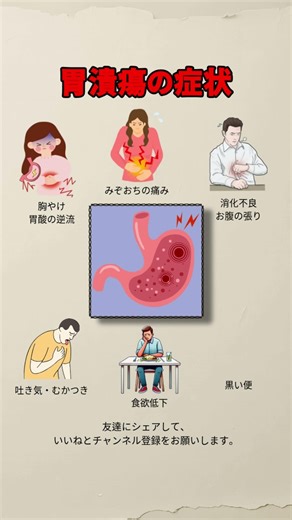 胃潰瘍でよく見られる症状6つ