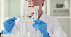 Urine pH test strips closeup. Doctor or laboratory scientist conducting a test with litmus strips