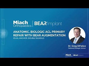 Dual Anchor Double Bundle BEAR Implant Surgical Technique | Dr. Gregory DiFelice