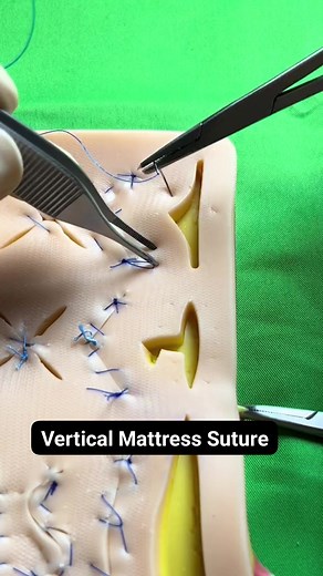 19K views · 190 reactions | Vertical Mattress Suture | MF HealthCare | Facebook