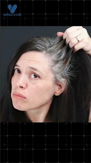 Itchy Scalp After Hair Color? ⚠️ Hair Dye Allergy Explained by Dr. Vipul