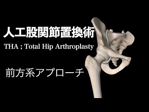 【医学】人工股関節置換術・前方系アプローチ