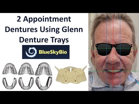 2 Appointment Dentures Using Glenn Denture Trays Full Tutorial