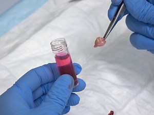 Characterization and Isolation of Mouse Primary Microglia by Density Gradient Centrifugation