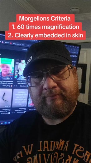 The two criteria of #Morgellons that characterize the #skincondition