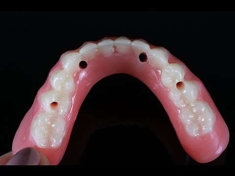 Smart Denture Conversions System - DDC Webinar