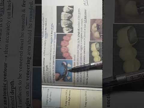 Pontic design part 2 🫵