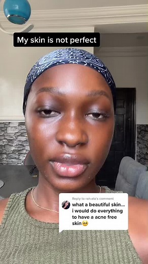 Reply to @rah.ela i still struggle with hyperpigmentation and acne sometimes. I’ve just learnt how to manage them and use products that work for me