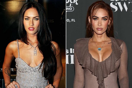 Megan Fox Wanted 'the Biggest Boobs You Can Fit in My Body' After 'Traumatizing' Breast Surgeries