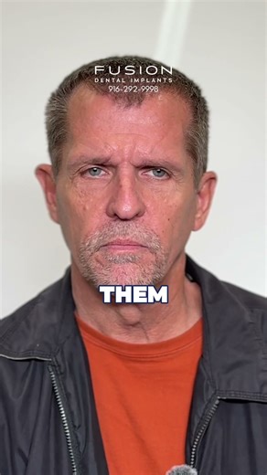 Relearning how to smile after dental implants