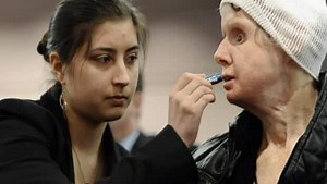 Chimpanzee attack victim pushes for new law