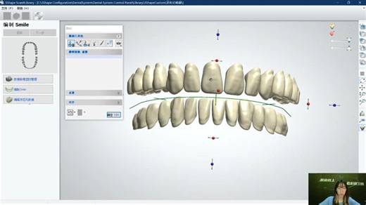 【牙齿数据库】基于3Shape Dental System的牙齿数据库建立｜Dental Forever