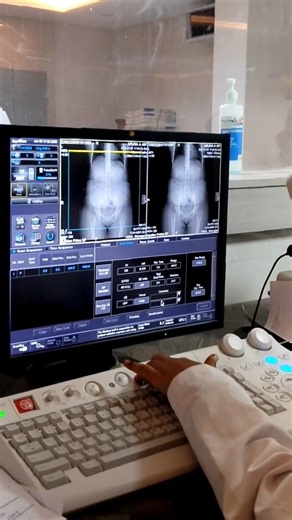 How to perform CT Abdomen Scan #radiology #ctscans #ctabdomenb