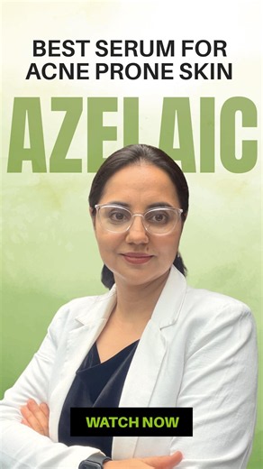 The Best Azelaic Acid Serums for Acne & Dark Spots #acnetreatment #skincareroutine #dermatocare