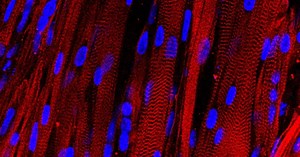 First contracting human muscle ever grown in laboratory