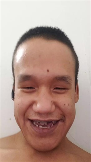 Laughing for no reason