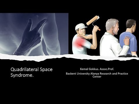 Quadrilateral Space Syndrome.