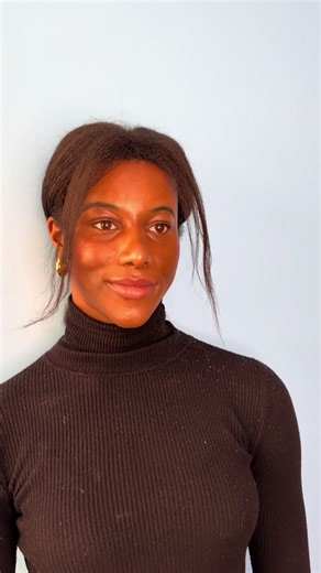 Achieving Natural Facial Feminization Results