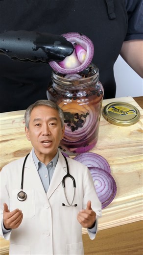 97K views · 994 reactions | I've discovered the easiest and tastiest way to make pickled onions! | Top Kitchen | Facebook