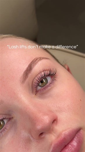 Transform Your Look with a Lash Lift: Process Explained