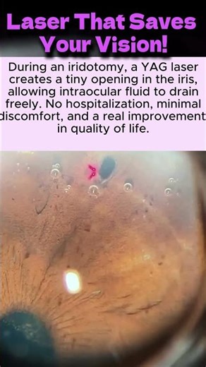 Laser That Saves Your Vision!