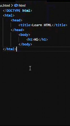 🔥Day 3/30 — HTML Structure Explained