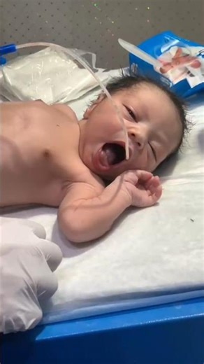 newborn baby deep suction emergency care & critical baby#emergency #baby#neonatal#nicu