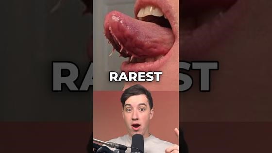 Rare human traits that appear in only a small population