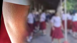 May 32 ka kaso sang viral exanthem ukon makayha sa NOHS #ViralExanthem #Makayha #NOHS | Digicast Negros