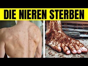 DIE NIEREN STERBEN! 10 SELTSAME ANZEICHEN FÜR NIERENSCHÄDEN!