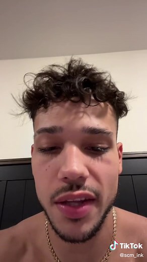 Understanding Ink Sacks After Tattoos: Causes and Removal