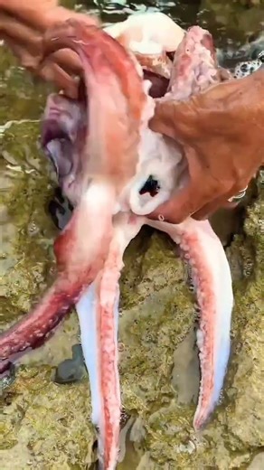 Squid Tooth removal