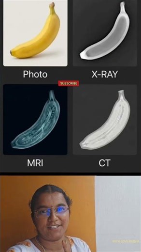 scan picture explanation#scan#xray#ctscan#mriscan#doctor#medical#shorts#trending#viral#reels#new#yt