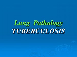 Lung Pathology TUBERCULOSIS - SlideServe
