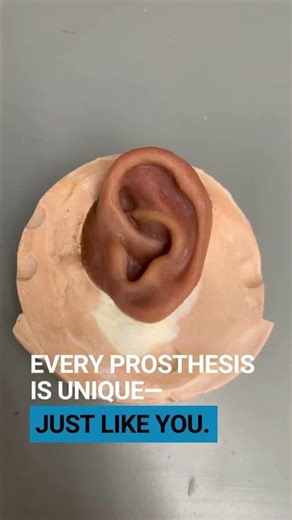 Every ear is unique, so should your prosthetic be.