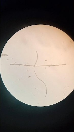 Chromosomes under Microscope #lab #microscope #explore