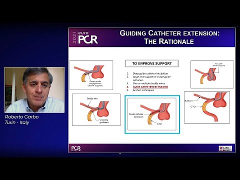 Overcoming the tortuosity in complex PCI - EuroPCR 2021