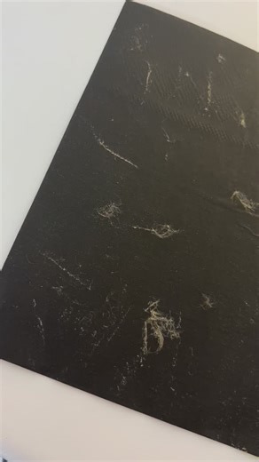 Hifu | Facials | Laser Hair Removal | Aesthetics on Instagram: "Dermaplaning is one of my favorite treatments to see the instant results is soooooo satisfying Dermaplaning is a gentle, non-invasive exfoliation treatment that uses a sterile blade to remove dead skin cells and fine facial hair (“peach fuzz”). 🌟Smoother texture: Instantly removes surface dead skin for a soft, polished feel 🌟Brighter complexion: Helps reduce dullness and boosts natural glow 🌟More even tone: Can soften the look of