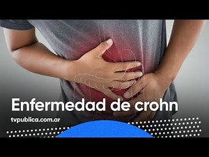 Diagnóstico y tratamiento de la enfermedad de Crohn – En Casa Salud