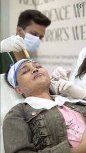 Full Face Filler Treatment at Dr. Haror’s Wellness