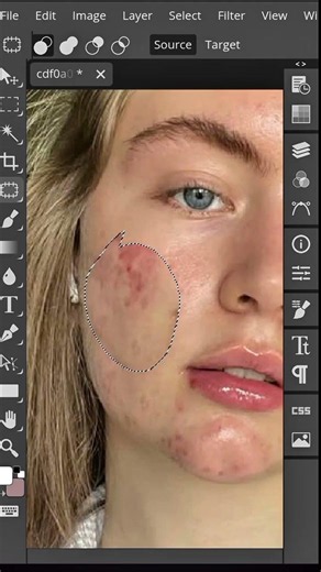 How to Remove Pimples in Photopea Mobile | Easy Skin Retouching Tutorial