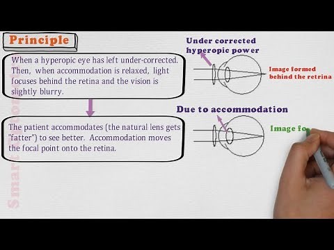 Fogging Method - Binocular Subjective refraction (4/4)