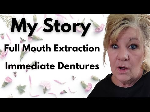 Full Mouth Extraction and Immediate Dentures