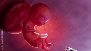 3D rendered medical animation of an abortion