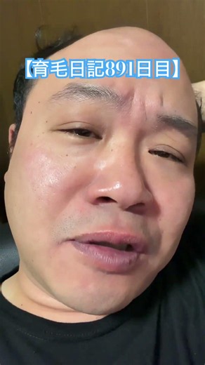 [Hair Growth Diary Day 891] That Age Where You Start to Worry #Gameplay #Diary #HairGrowth