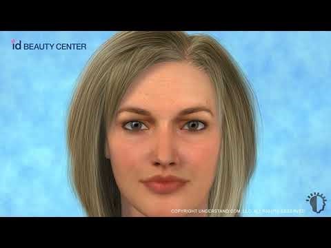 Botox | How Does Botulinum Toxin Work and treatment