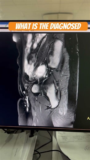 Mri pelvis cont
