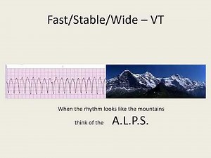 ACLS 2020 Algorithm Tachycardia