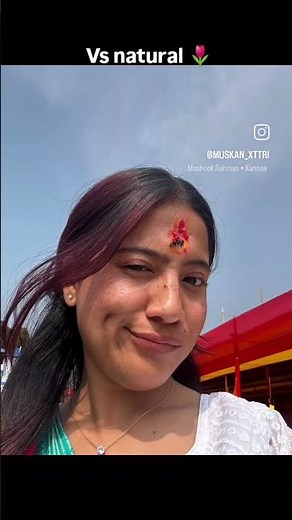 Natural dimples are they actually genetic mutations