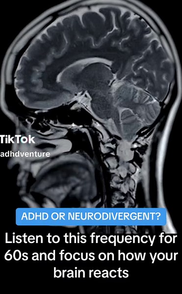 Frequency Sounds for ADHD and Neurodivergent Individuals